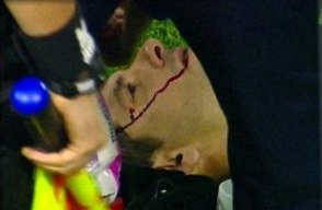 Болельщики разбили голову вратарю!